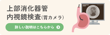 上部消化器官内視鏡検査（胃カメラ）詳しい説明はこちらから